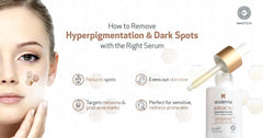 How to Remove Hyperpigmentation and Dark Spots with the Right Serum