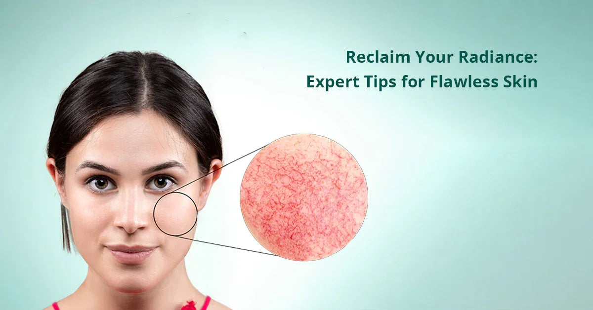 Key Differences between Hyperpigmentation and Melasma