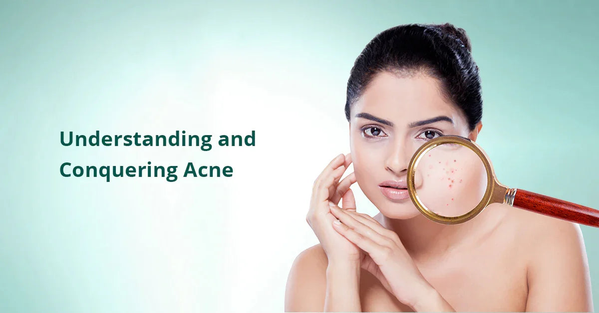 How to remove pimples naturally and permanently ?