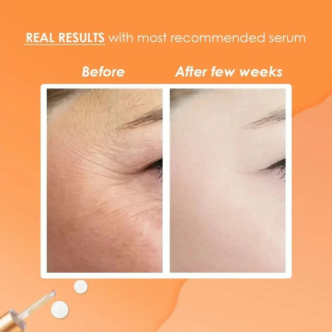 sesderma Vitamin C Serum
