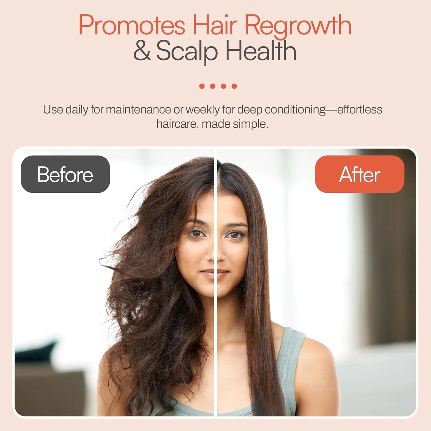 Foltene Pharma Conditioner Hair Beautifier 180ml