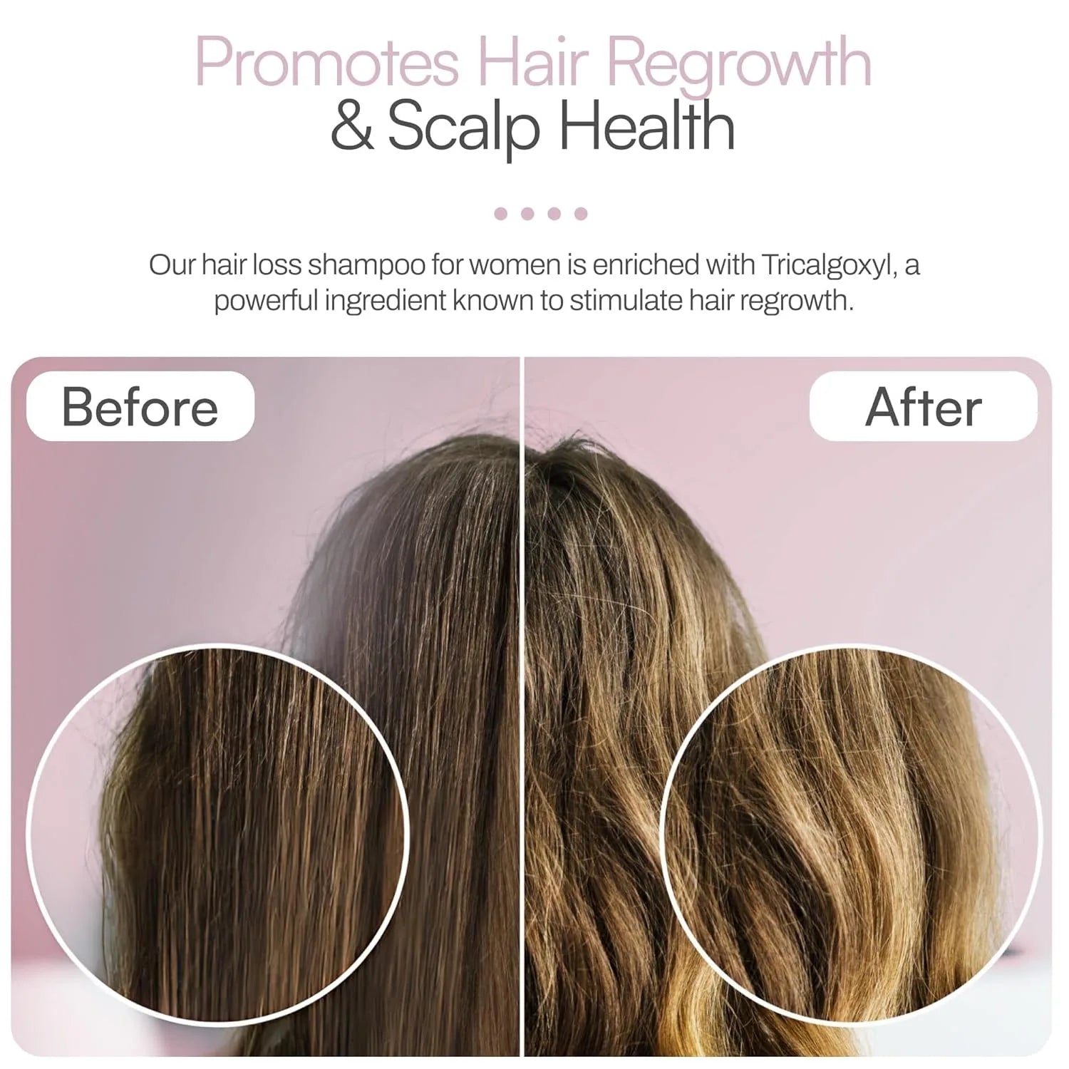 Foltene Pharma Strengthening for Thinning Hair Women Shampoo 200ml